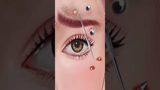 asmr Eye Stone Removal amp Eyelid Sebum Extrusion Meibomian Gland Cleaning animation beautyshorts [upl. by Ronalda]