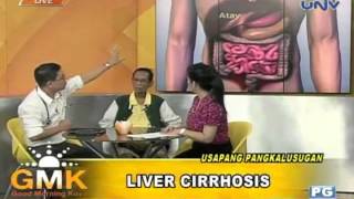 Usapang Pangkalusugan Liver Cirrhosis [upl. by Line]