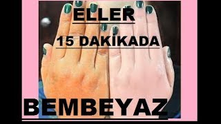 15 DAKİKADA GÜNEŞ LEKESİ  YAŞLILIK LEKESİ GİDERİCİ BEYAZLATICI  DOĞAL EL BAKIMI  Güzellik Bakım [upl. by Quintana]