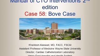 Case 58 Manual of CTO Interventions  eCART [upl. by Emilee]