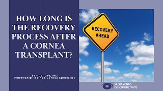 How long is the recovery after a cornea transplant [upl. by Stevie]