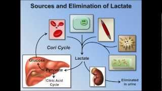 Elevated Anion Gap Metabolic Acidosis ABG Interpretation  Lesson 8 [upl. by Ntsud85]