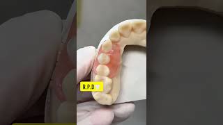 Removable partial denture 🦷 [upl. by Adlare]