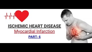 Ischemic Heart Disease  part6  Myocardial Infarction  HINDI [upl. by Anthia908]