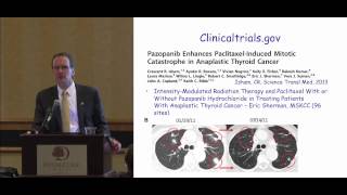 Anaplastic Thyroid Cancer Discussion Questions Answers Dr Haugen ThyCa Conference [upl. by Blaine422]