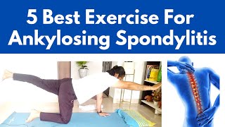 Ankylosing Spondylitis Treatment  Causes Symptoms And 5 Best Exercises For AS Pain Relief [upl. by Cnut]