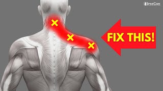 How to INSTANTLY Fix Pinched Nerve Pain in the Neck and Shoulders [upl. by James529]