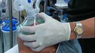 NT About Anesthesia Ch 5  General Anesthesia [upl. by Roth]