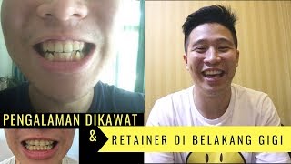 Pengalaman Dikawat dan Retainer yang di Belakang Gigi GA KELIATAN [upl. by Einwat823]