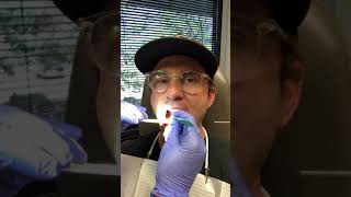 Marsupialization of oral ranula aka removing bubble under tongue [upl. by Nirret]