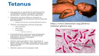 Tetanus  Epidemiology and Associated Complications [upl. by Keener]