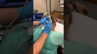 Migraine Headache Treatment Occipital Nerve Blocks [upl. by Esetal]