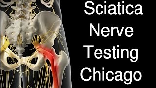 Sciatica Nerve Test Chicago [upl. by Zippora]