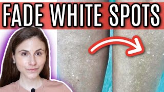 How to FADE WHITE SPOTS from SUN DAMAGE  Dr Dray [upl. by Tiras]