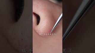 immersive skin care strawberry nose blackhead deep pore cleaning skin management [upl. by Ryle636]