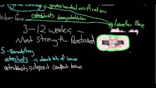 Mechanism of fracture healing [upl. by Toh]