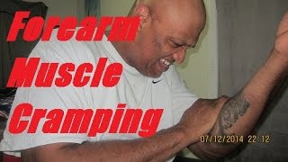 Forearm Muscle Cramping  Fasciculation Syndrome [upl. by Val]