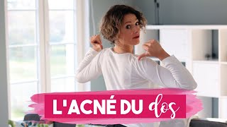 ACNE dans le DOS  5 CONSEILS pour vous en DEBARRASSER [upl. by Eelarol]