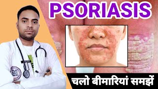 psoriasis kya hai how to treat psoriasis ❤️💥💯 raheesansari [upl. by Tnahs]