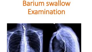 easy way to take a Barium Swallow X ray  X ray barium swallow step by step instructions [upl. by Etyam]