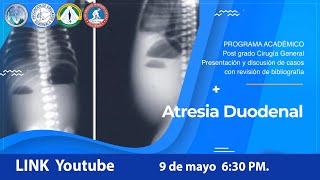 Programa Académico Atresia Duodenal [upl. by Akemor]