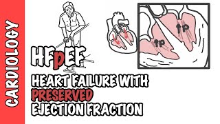 HFpEF  Heart Failure with Preserved Ejection Fraction [upl. by Crandell806]