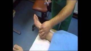 Foot Surgery Toe Straightening Procedure [upl. by Gonagle228]