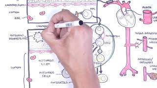 Vasculitis Pathophysiology Overview [upl. by Fredette]