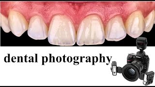 dental photography [upl. by Aubigny]