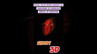 Mitral Valve Repair Surgery 3D Animations 3D Cardiology Medical Animation short 🫀 [upl. by Aniraz167]