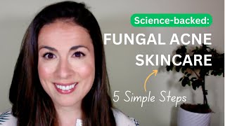 Fungal Acne Skincare Routine 5 Simple Steps  EvidenceBased [upl. by Cirri477]