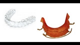 Types of Orthodontic Retainers  and How to Clean Them [upl. by Nettirb]