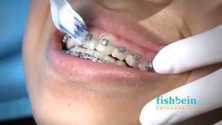 Orthodontic Home Care Instructions  Braces  Brushing [upl. by Shina]