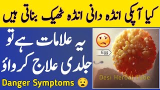 Do your ovaries produce eggs properly  Ager Ya Symptoms Ha Tu Ilaj Kervao  Danger Symptoms [upl. by Enaira]