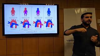 TGA Perioperative Management  Mohamed Elgayyar [upl. by Semajwerdna594]