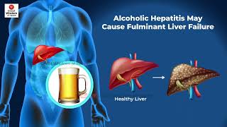 What is Fulminant Hepatitis  Fulminant Hepatic Failure  Hepatitis [upl. by Esilegna273]