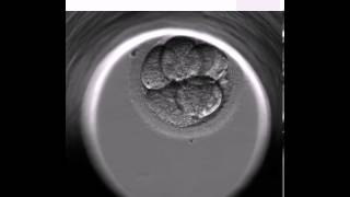 BONITO EMBARAZO CON EMBRYOSCOPE [upl. by Ozzy]