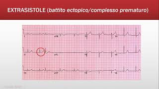 ECG Base Ritmo  Quiz FOAMed [upl. by Eojyllib4]