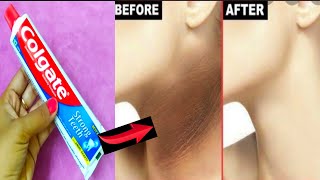 How to get rid dark neck in a few minutes  Toothpaste neck cleaning  neck black remove tips [upl. by Lauralee]