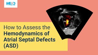 How to Assess the Hemodynamics of Atrial Septal Defects ASD [upl. by Leyes]