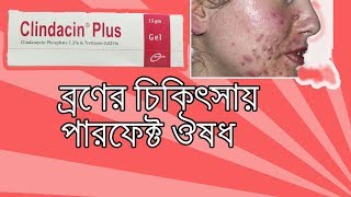 Clindacin Plus Gel  what is clindamycin gel used to treat Bangla [upl. by Jarnagin]