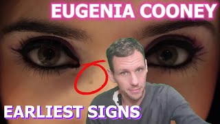 Warning signs in Eugenia Cooneys earliest content [upl. by Mahseh739]