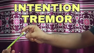 Intention Tremor  Simplified ✔ [upl. by Ahsot504]