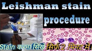 Lishman stain Procedure [upl. by Anileve]