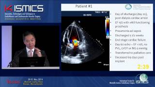 Preclinical Evaluation Of The Tiara Transapical Mitral Valve Replacement Device [upl. by Ihcego]