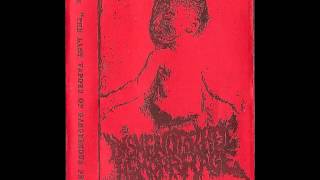 Dysmenorrheic Hemorrhage  The Last Vapor Of Gangrenous Fetor Full Album [upl. by Corso]