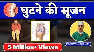 Swelling in Knee JointHindi घुटने की सूजन घुटने में पानी भर गया है Knee Pain and Swelling [upl. by Yahsram]