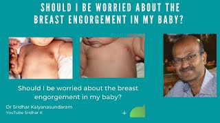 Should I be worried about the breast engorgement in my baby Neonatal mastitis breastenlargement [upl. by Elkraps504]