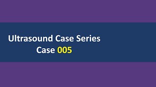 Ultrasound Case 005 [upl. by Illoh]