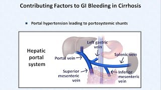 Esophageal Varices and Variceal Hemorrhage [upl. by Yeung]